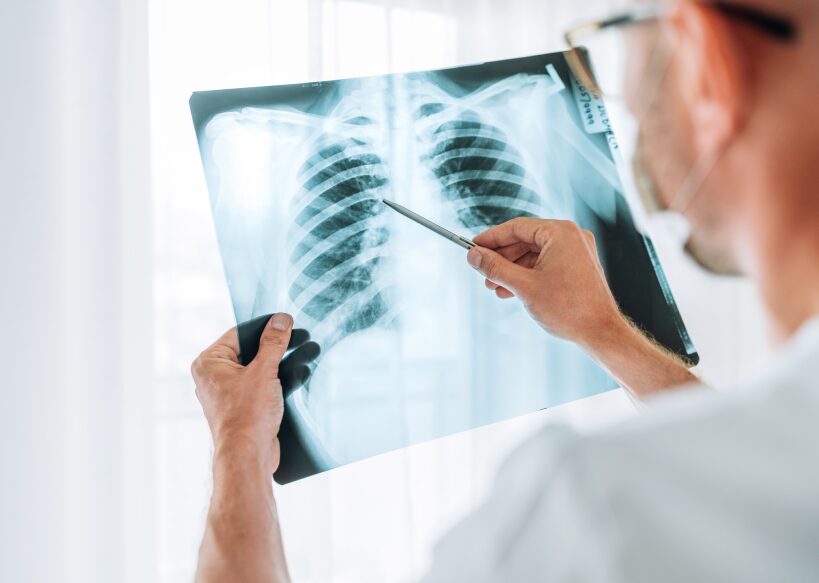 blood work and x-ray Etobicoke